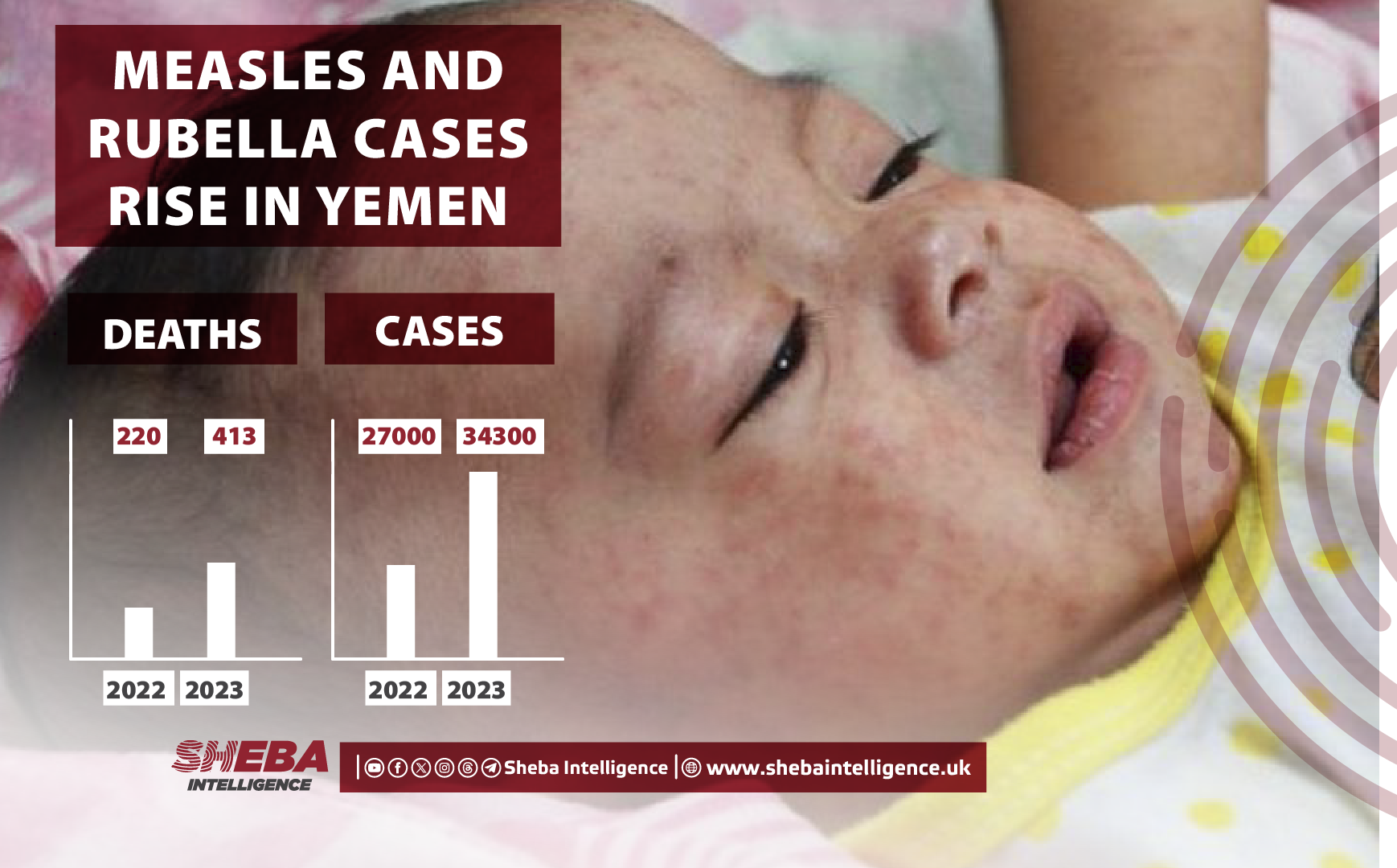 Measles and Rubella Cases Rise in Yemen